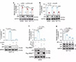p53應答lncRNA GUARDIN 對基因組穩定性至關重要